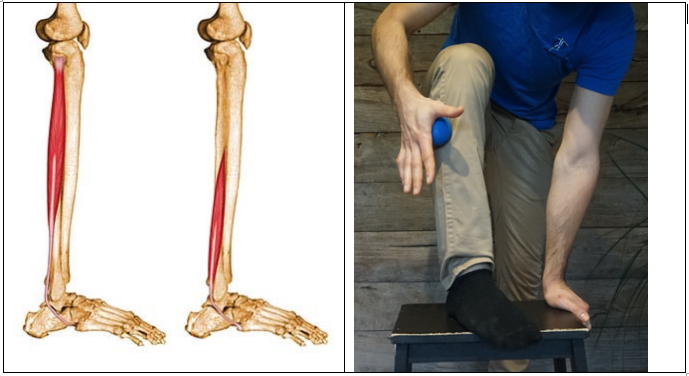 What Does Numbness In The Lower Leg Mean