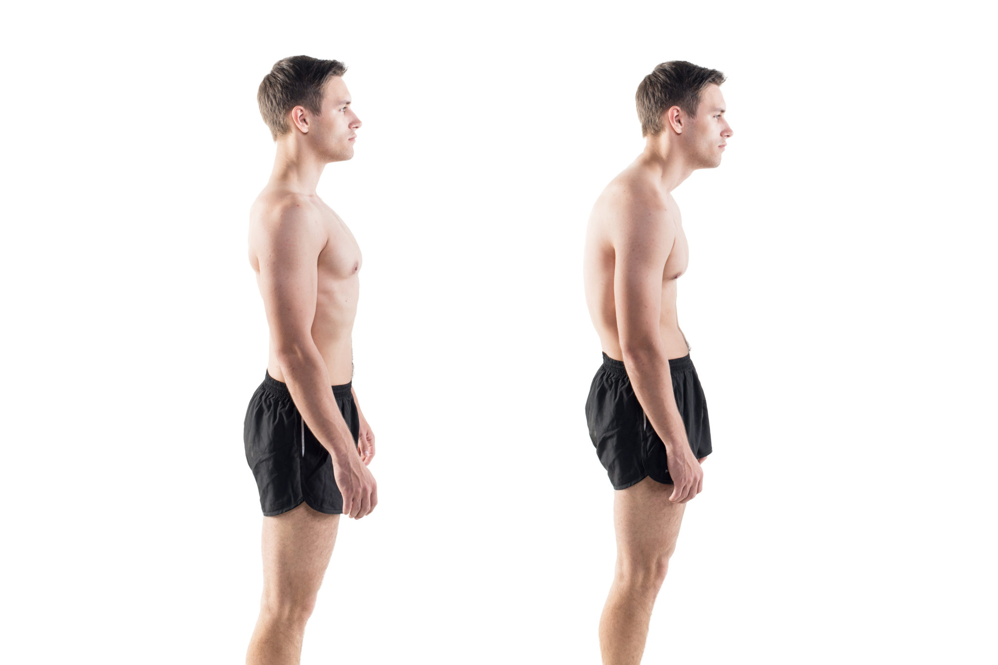 A Stooped Posture Is Associated With Higher Mortality Rates 